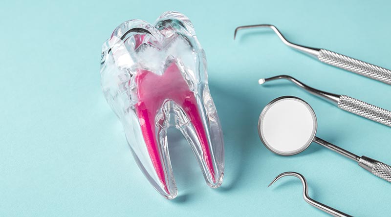 Prothese oder Implantat